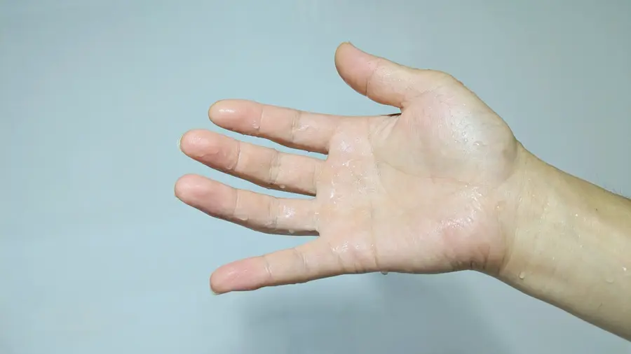 手汗がひどい方へ、体質だからで終わらせないで！原因や治療法を解説